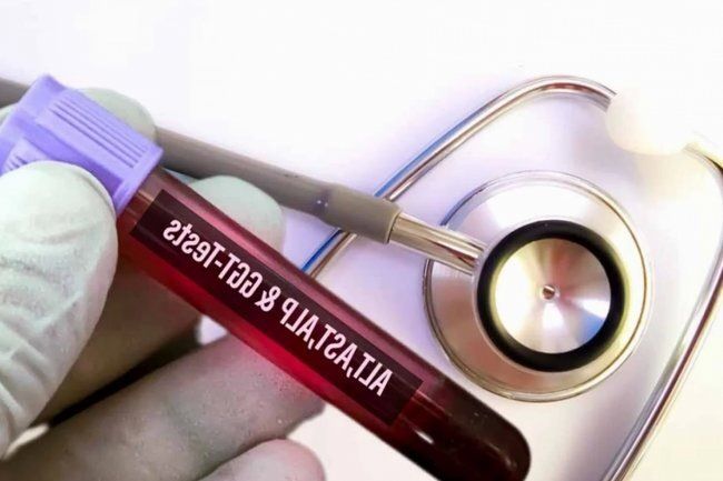 Как проверить здоровье печени: три анализа, которые могут спасти вашу жизнь